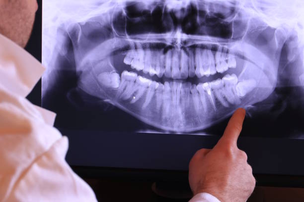 Best Emergency Treatment for Jaw Pain or Injury in Arcola, TX